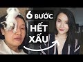 6 bước để hết xấu