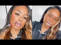 VLOG: I GOT LIP FILLER!! | IV HYDRATION + LIP INJECTIONS + MUKBANG KAZ RAMEN