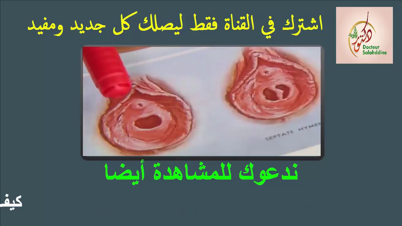 كيفية فض غشاء البكارة دكتورة مصرية تعلمك طريقة فض البكارة Youtube 