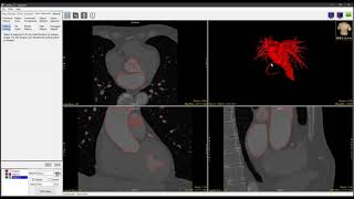 Celebrity Analyze 14.0 - Segment: Oblique Cutting Wealth