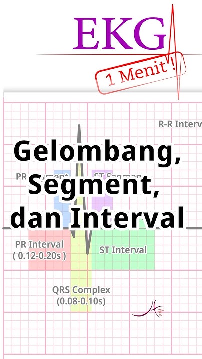 EKG 1 Menit: Mengenal Gelombang, Segment, dan Interval - YouTube