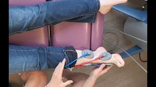Bunion Treatment Oakville - Shockwave Therapy - Treatment for Bunion Pain - Dr. Steve Knighton