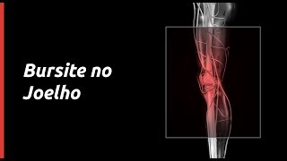 Saiba tudo sobre: Bursite no Joelho