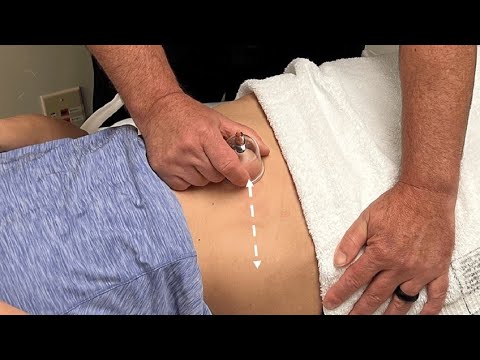 چارەسەری قۆڵۆن عەسەبی ئازاری سووڕی مانگانە ناوک هێنانەوە بەڕێگایەکی سروشتی و تەندروستی 