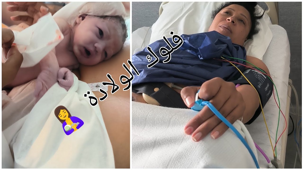 فلوك الولادة 🤱في فرنسا 🇫🇷