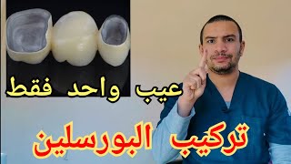 هل تركيبات البورسلين للاسنان قويه و تتحمل |افضل نوع تركيب بورسلين