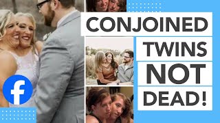 'Conjoined Hensel Twins Dead' Is FALSE And Scammy. Do Not Believe These Lies