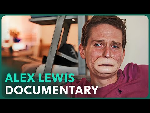 The Extraordinary Case of Alex Lewis | Real Stories