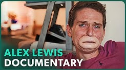 The Extraordinary Case of Alex Lewis (Medical Miracle Documentary) - Real Stories