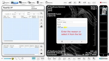 Rejecting an Image on Examvue DR Vet