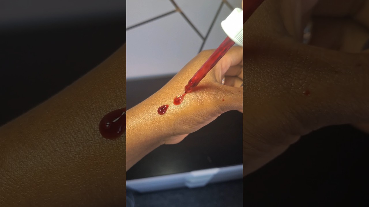 The At-Home Peel That Changed My Skin!