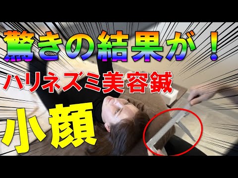 【ロシア人モデル施術】小顔になりたい方必見！まさかの結果！？ロシアモデルでもここまでの効果が！〜KADOMORI〜