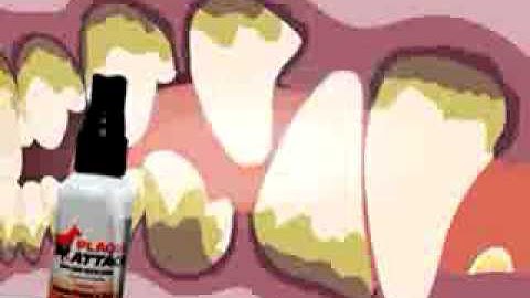 Plaque Attack Spray As Seen On Tv