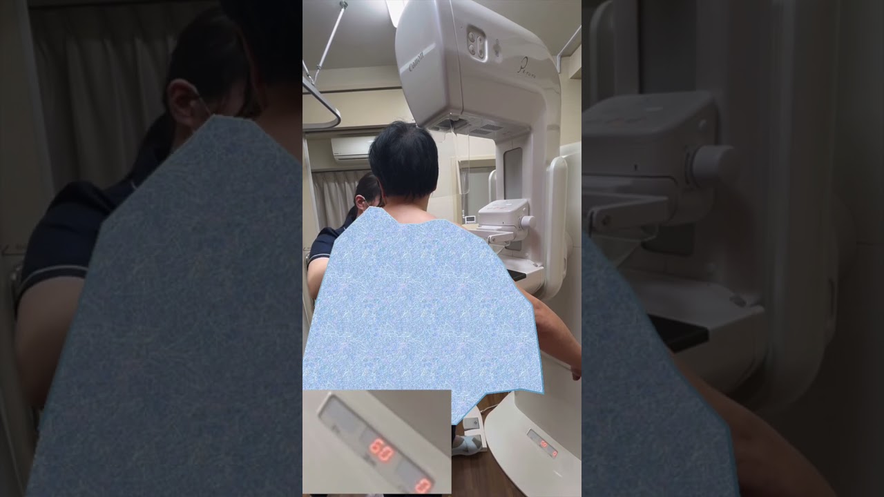 マンモグラフィ 技師 男性