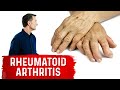 Use These Spices and Herbs for Rheumatoid Arthritis – Remedies for Rheumatoid Arthritis – Dr.Berg