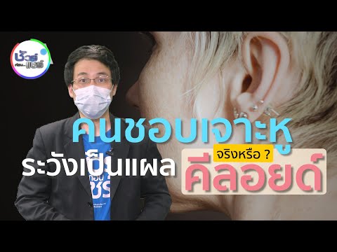 ชัวร์ก่อนแชร์ : คนชอบเจาะหูต้องระวังเป็นแผลคีลอยด์ จริงหรือ ?