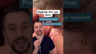 Derm explains preauricular sinus??