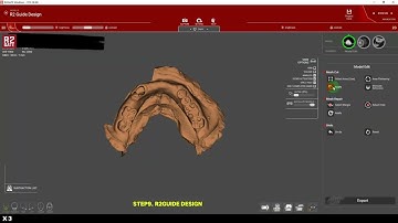 Oneday One case design by R2GATE SA version [2024.10.04]