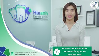 List 1 Đánh giá Nha Khoa Thẩm Mỹ Hải Anh Hà Nội hay nhất