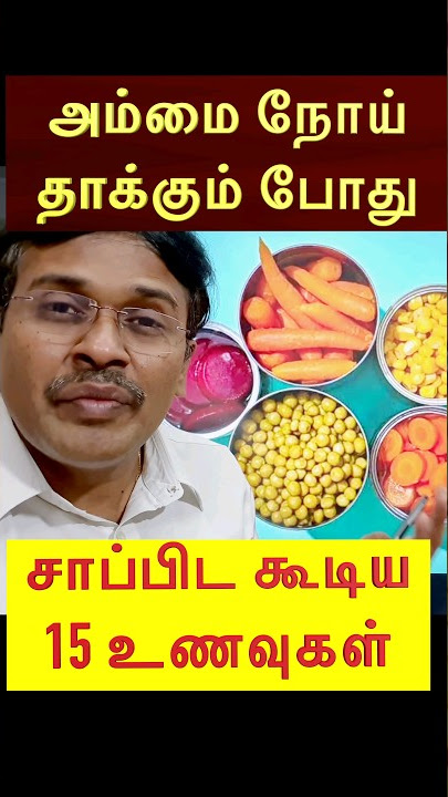 அம்மை நோய் என்ன சாப்பிடலாம்?