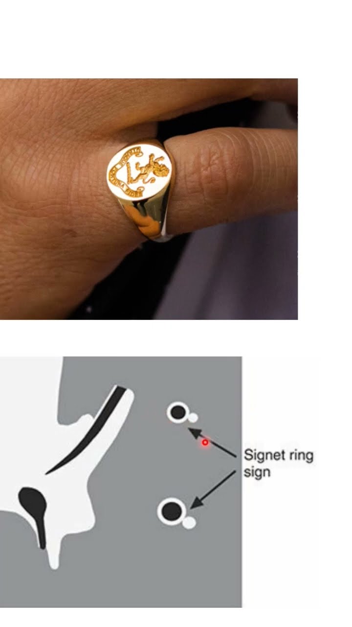 Habitually Chic® » The History and Etiquette of Signet Rings