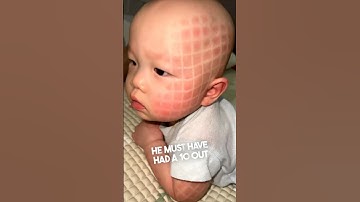 This baby looked completely different after a nap 😳