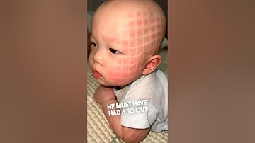 This baby looked completely different after a nap 😳