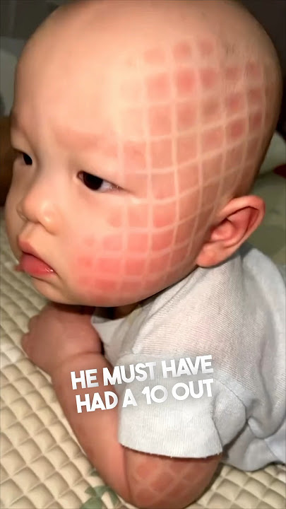 This baby looked completely different after a nap 😳