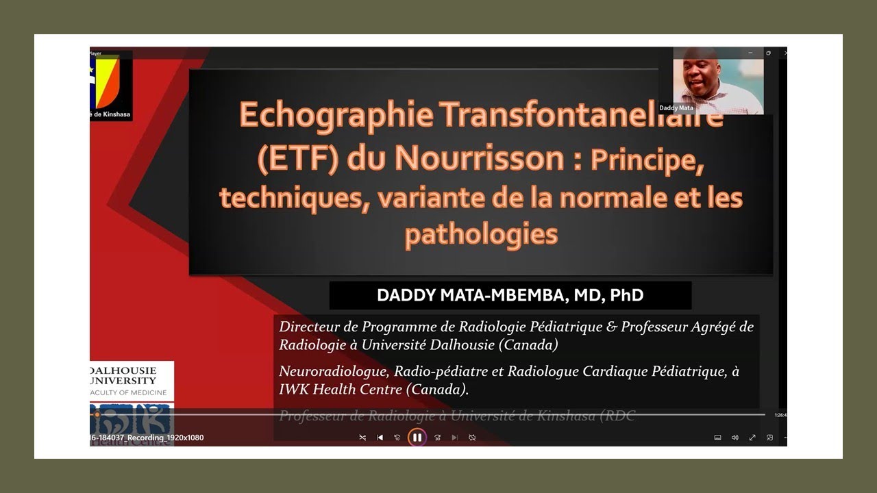 Echographie transfontanellaire du nourrisson: principe, techniques, normales et pathologies