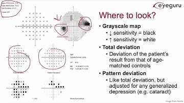 7.2 - Humphrey Visual Field