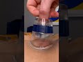 ⭕️Myofascial decompression (cupping)