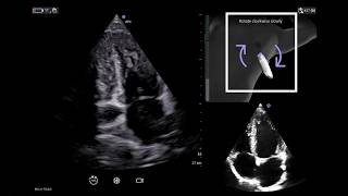 Vscan Air™ | Caption AI™ Prescriptive Guidance
