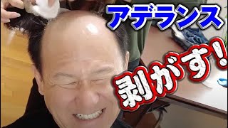 【衝撃】社長のアデランス剥がしてみた！嫌がる社長に無理矢理交渉！滑稽な姿に抱腹絶倒！！