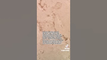 Urine Analysis | urinalysis | urine test #laboratory #microscope #mls #medtechstudent #cls #urine