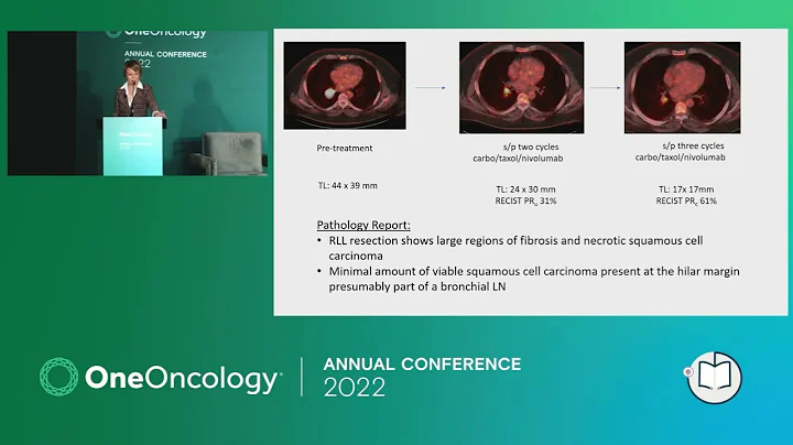 Local Lung Cancer | 2022 OneOncology Conference