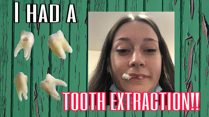 I Got My Teeth Pulled Out! - Casey Lowe