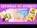 Como acabar com a foliculite ou bolinhas do bumbum