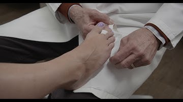 How to Tape Claw Toes | How to Tape Hammer Toes | Thomas Clanton, MD