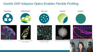 Spatial Transcriptomic Profiling of Spiny Projection Neurons in the Mouse Striatum