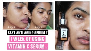 1 Week Of Using Vitamin C Serum Challenge Ft Stbotanica Vitamin C Facial Serum Youtube