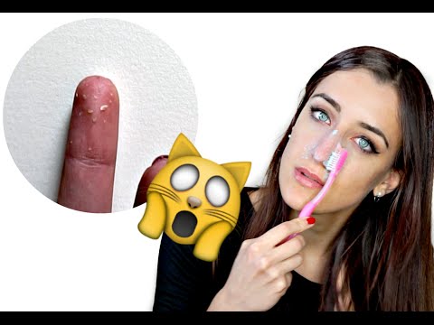 Video: 3 modi per pulire i pori del naso