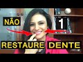 Não Restaure 1 Dente da Frente!!! Saiba tudo sobre Restaurações Estéticas do dente da Frente.