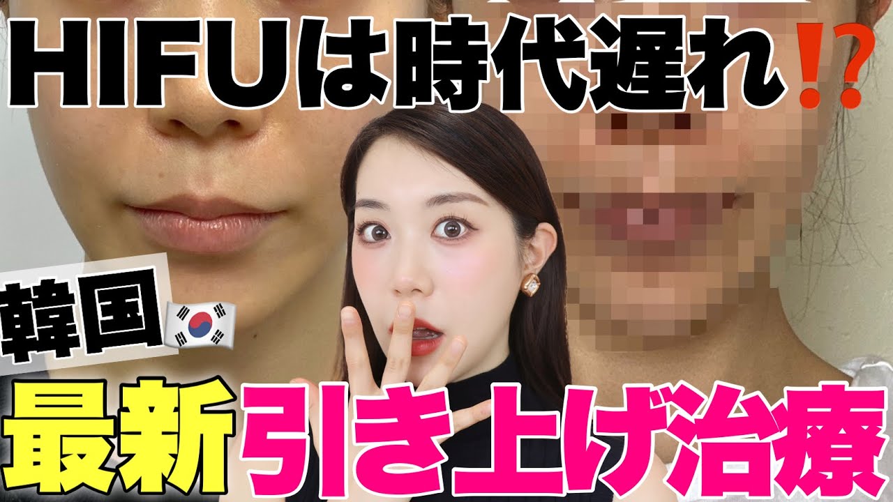 韓国美容医療！最新引き上げ治療が熱い🔥ダウンタイムほぼゼロ！たるみやほうれい線が消える⁉️