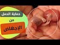 كيف أحمى حملى من الإجهاض ؟ نصائح هامة فى بداية الحمل | د/ ريهام الشال | موثق