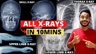 radiology anatomy | upper limb x ray anatomy viva | thorax x-ray anatomy practical | skull radiology