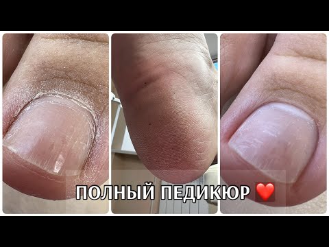 ПОЛНЫЙ педикюр без покрытия🤘🏻 SMART обработка стоп❤️ чудо спасение🙉 работа БЕЗ ПЫЛИ🔥