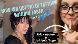 PT. 2 ~ IT’s WORKING!!! REMOVE TATTOOS  NO LASER ~ BEFORE AND AFTER ~ Salt Saline Lime DIY at home screenshot 2