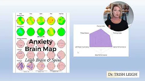 What Does an Anxiety Brain Map Look Like? (w/Dr. Trish Leigh)