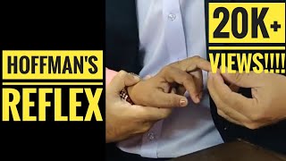 Hoffmann's Sign or Reflex