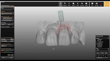 Zirkonzahn CAD/CAM Software Module Abutments
